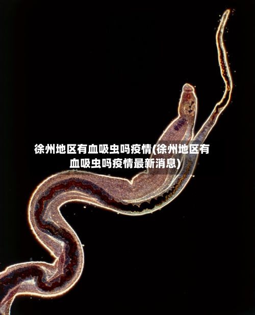 徐州地区有血吸虫吗疫情(徐州地区有血吸虫吗疫情最新消息)-第2张图片